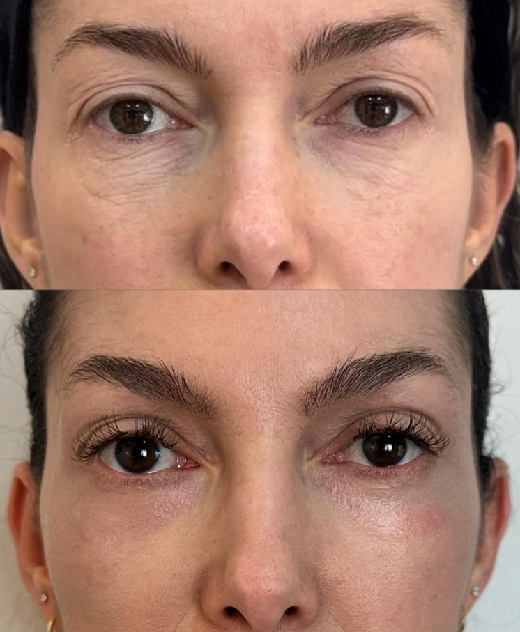 Cuidado com os olhos
